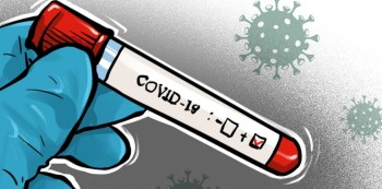 सुदूरपश्चिममा कोरोना भाइरस सङ्क्रमणदर उकालो लाग्दै