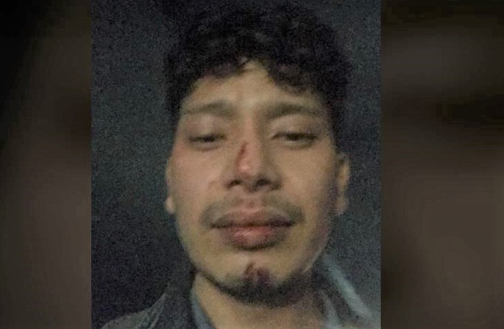 डाक्टर कुटपिट गर्ने ट्राफिक प्रहरी निलम्बित