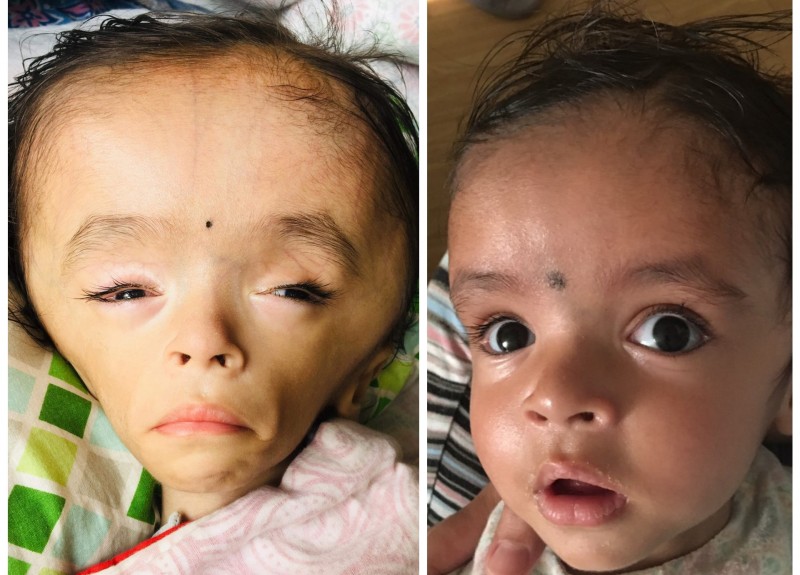 बच्चाको उपचारमा लापरबाही गरेकोमा ग्रान्डी अस्पतालले ३५ लाख रुपैयाँ क्षतिपूर्ति दिनुपर्ने